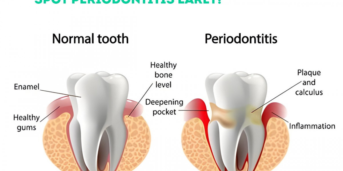 Comprehensive Gum Care: Finding the Right Periodontist in Hoodi Bangalore