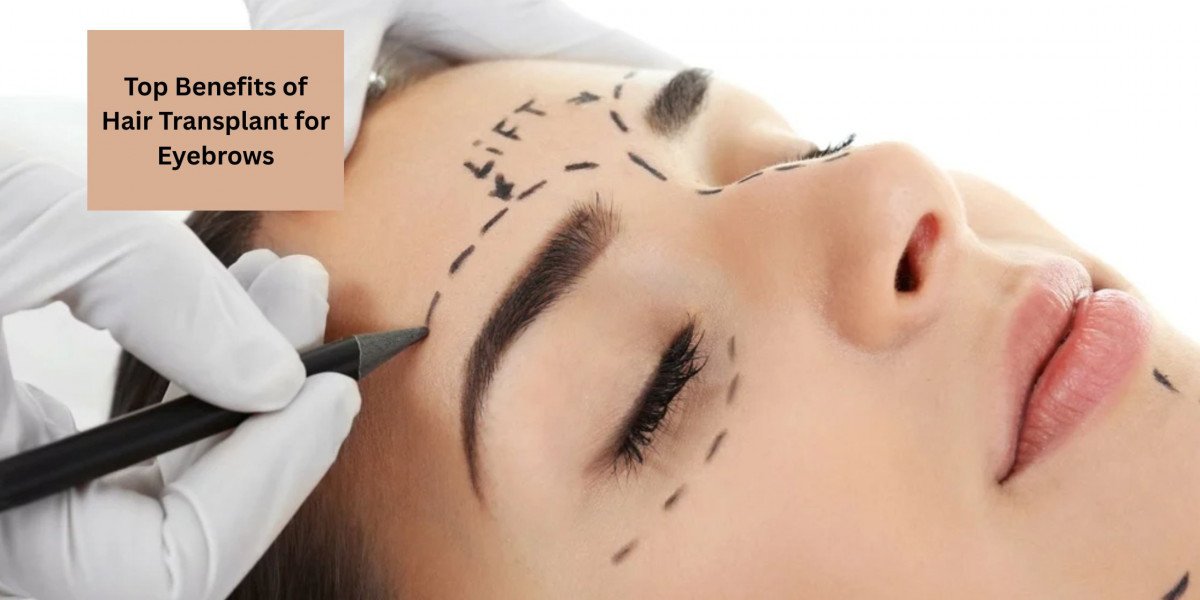 Top Benefits of Hair Transplant for Eyebrows