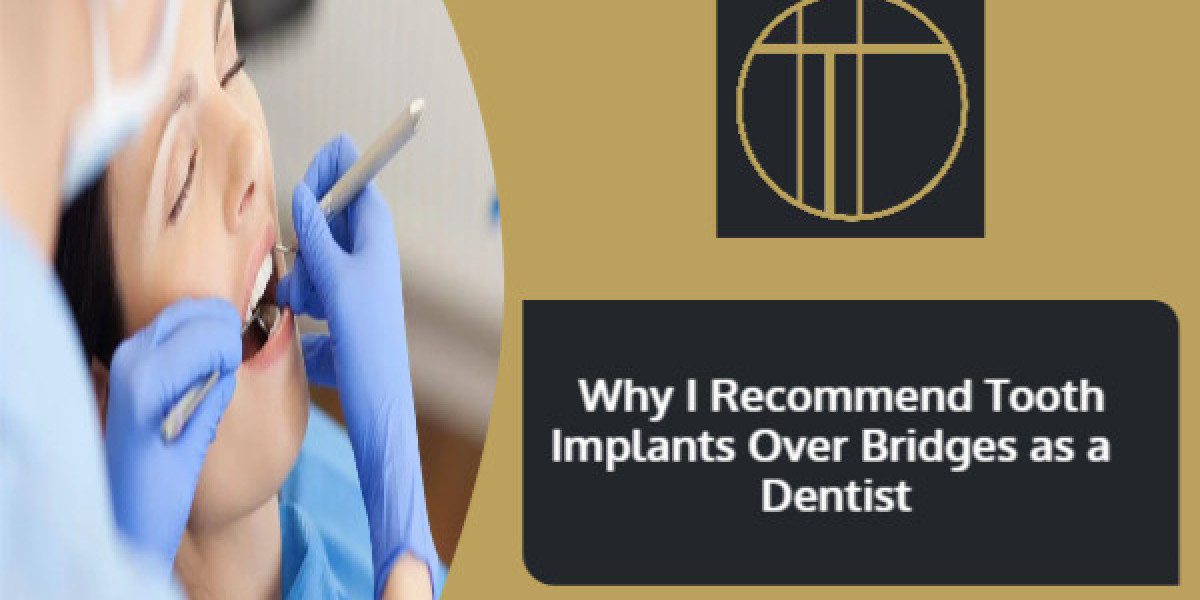 Why I Recommend Tooth Implants Over Bridges as a Dentist