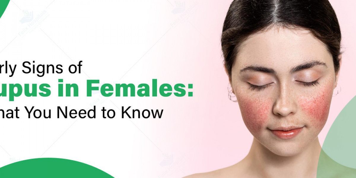 Lupus Symptoms in Women: Early Signs, Diagnosis, and Living with the Disease