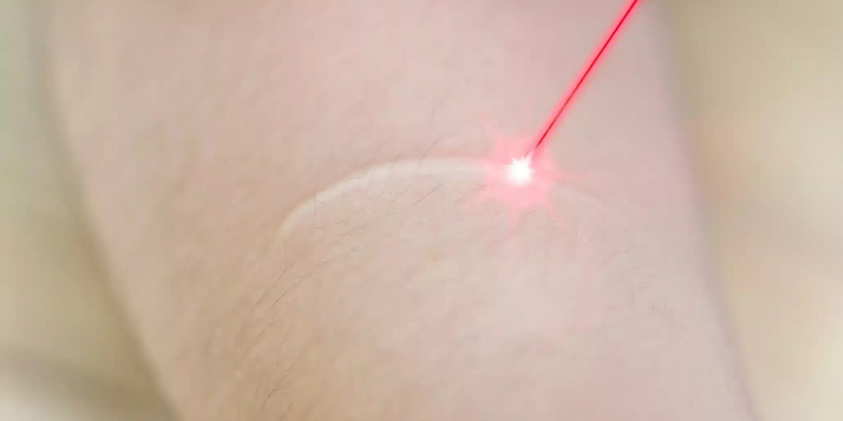 Restore Confidence with Advanced Laser Treatments at LifeStream Family Medicine